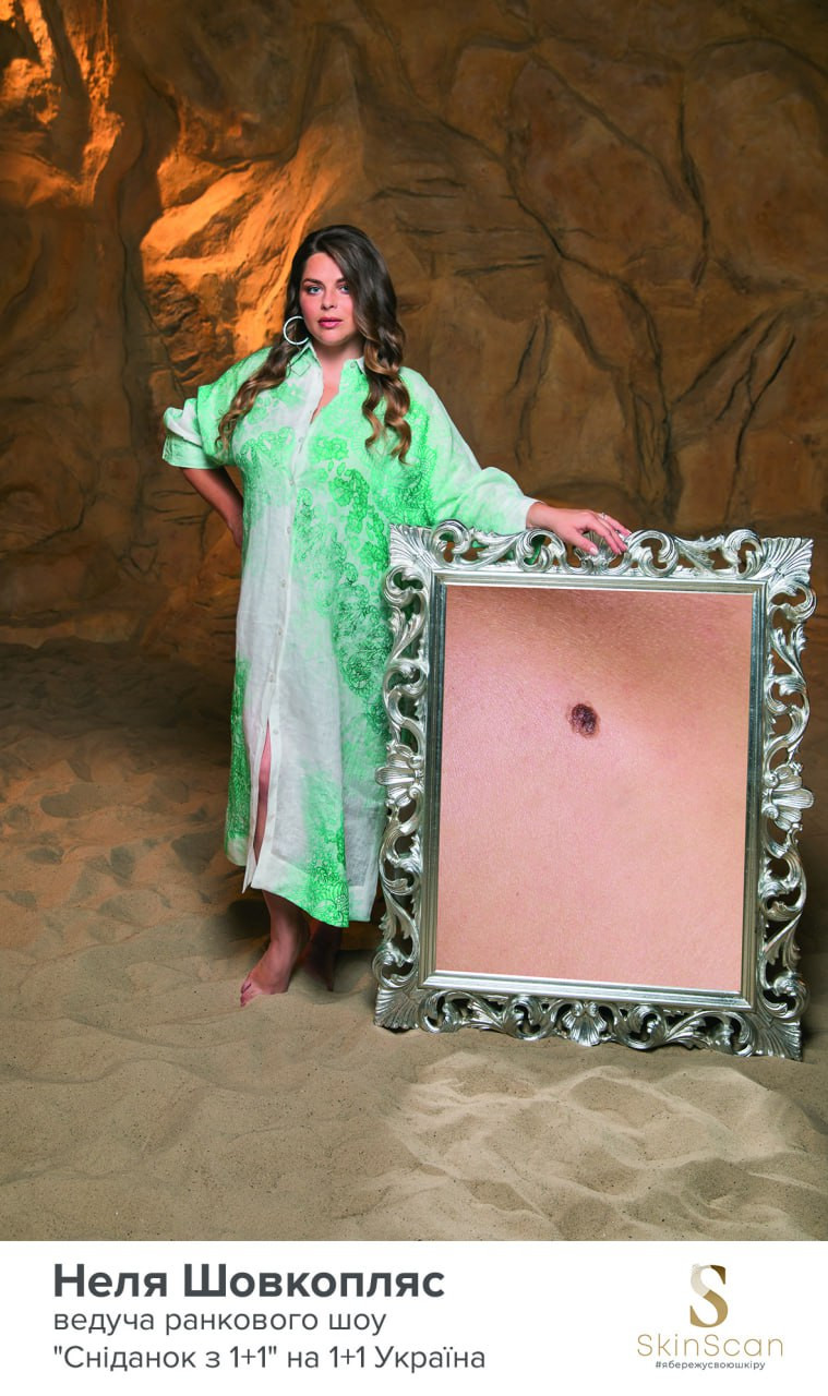 неля шовкопляс