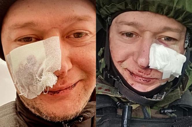 Андрей Хливнюк, лидер группы "Бумбокс" попал под миноментный обстрел в Киеве
