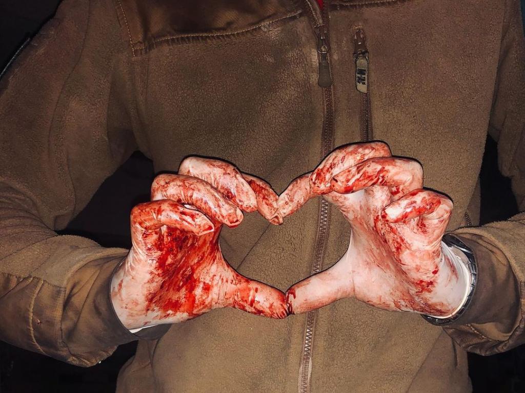 Медик "Азову" зробив фотографію своїх складених у серце закривавлених рук